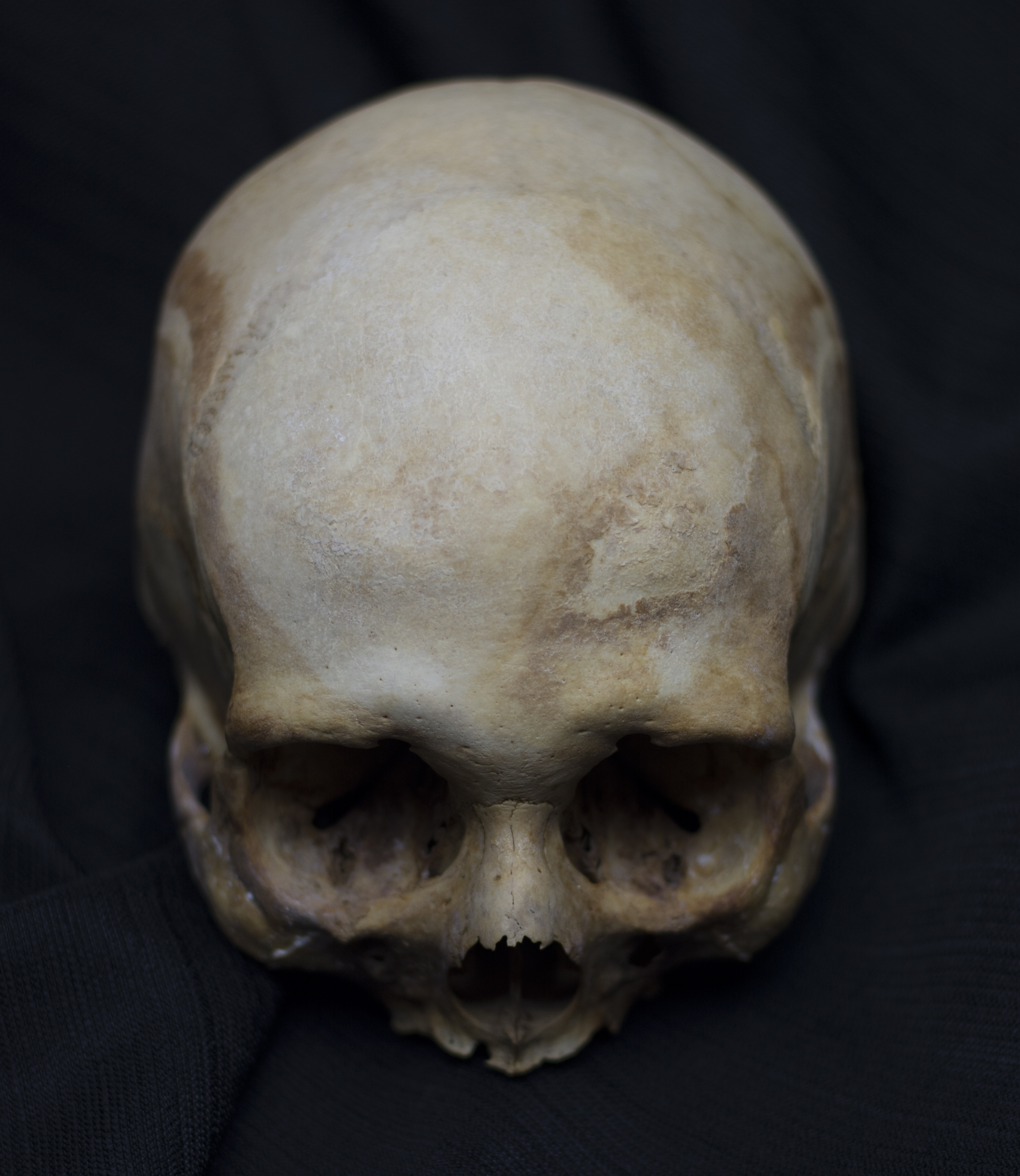 Человеческий череп без нижней челюсти