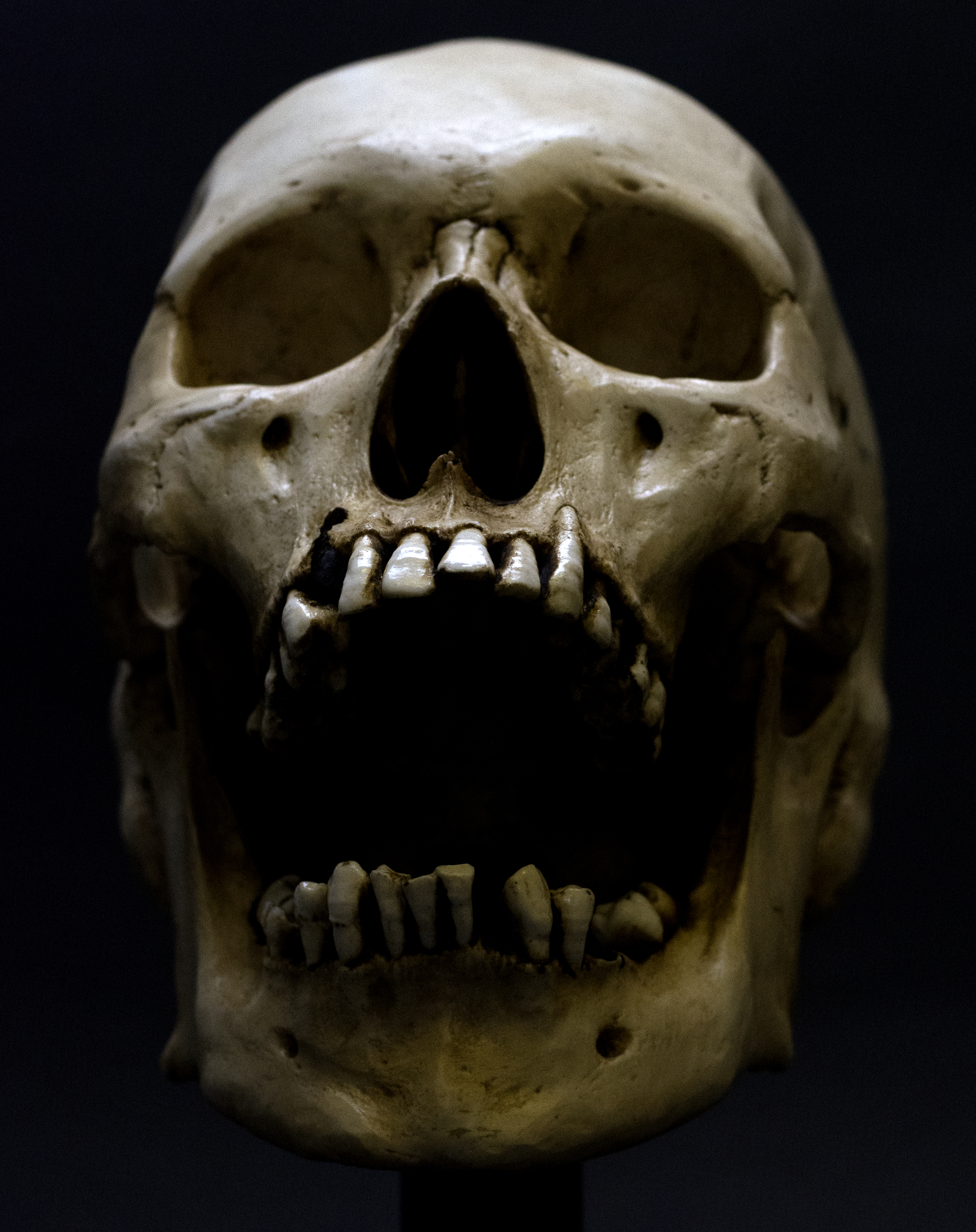 5 Weird Facts About The Human Skull And 5 High Res Images