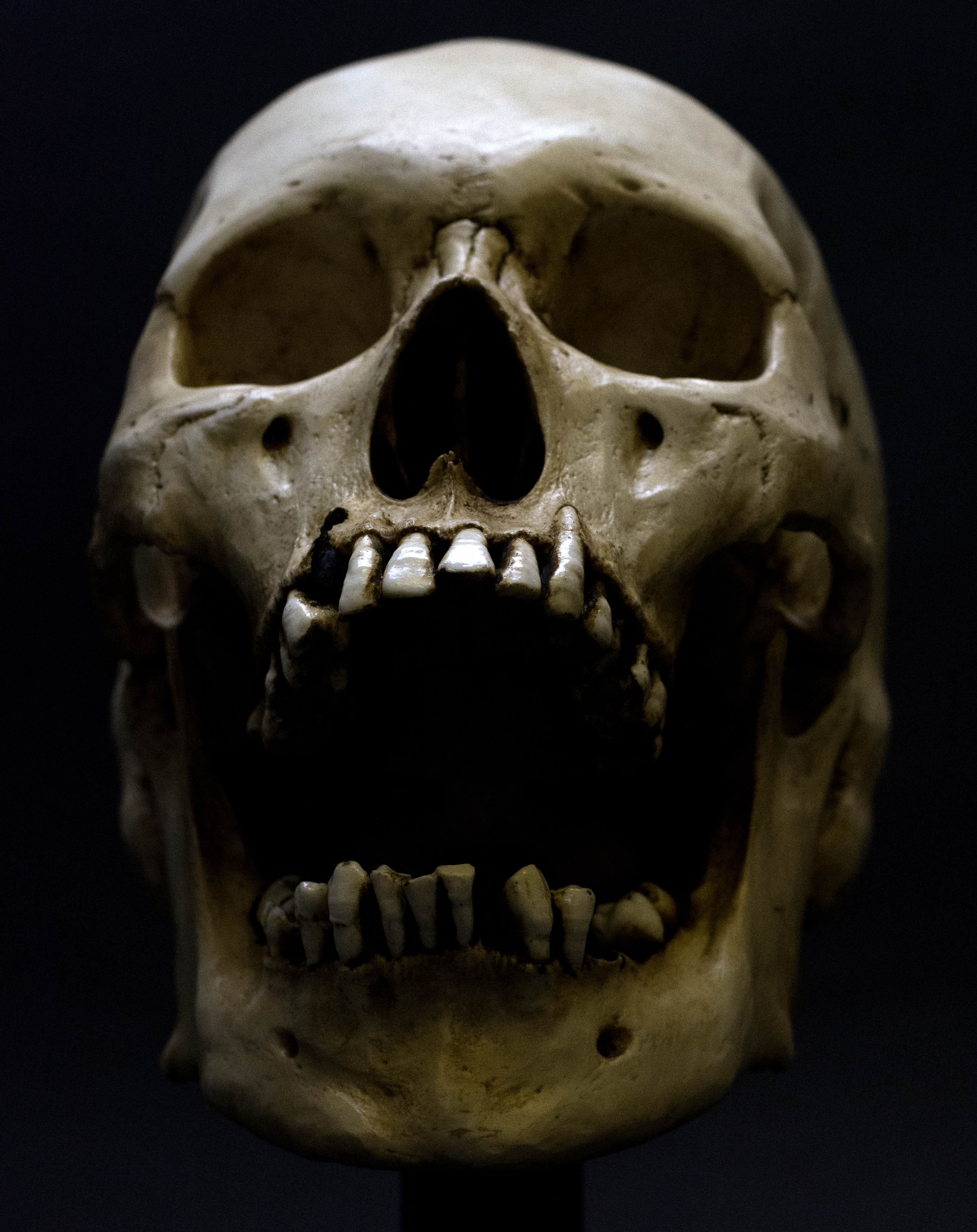 Five Fast Facts about Skull Anatomy