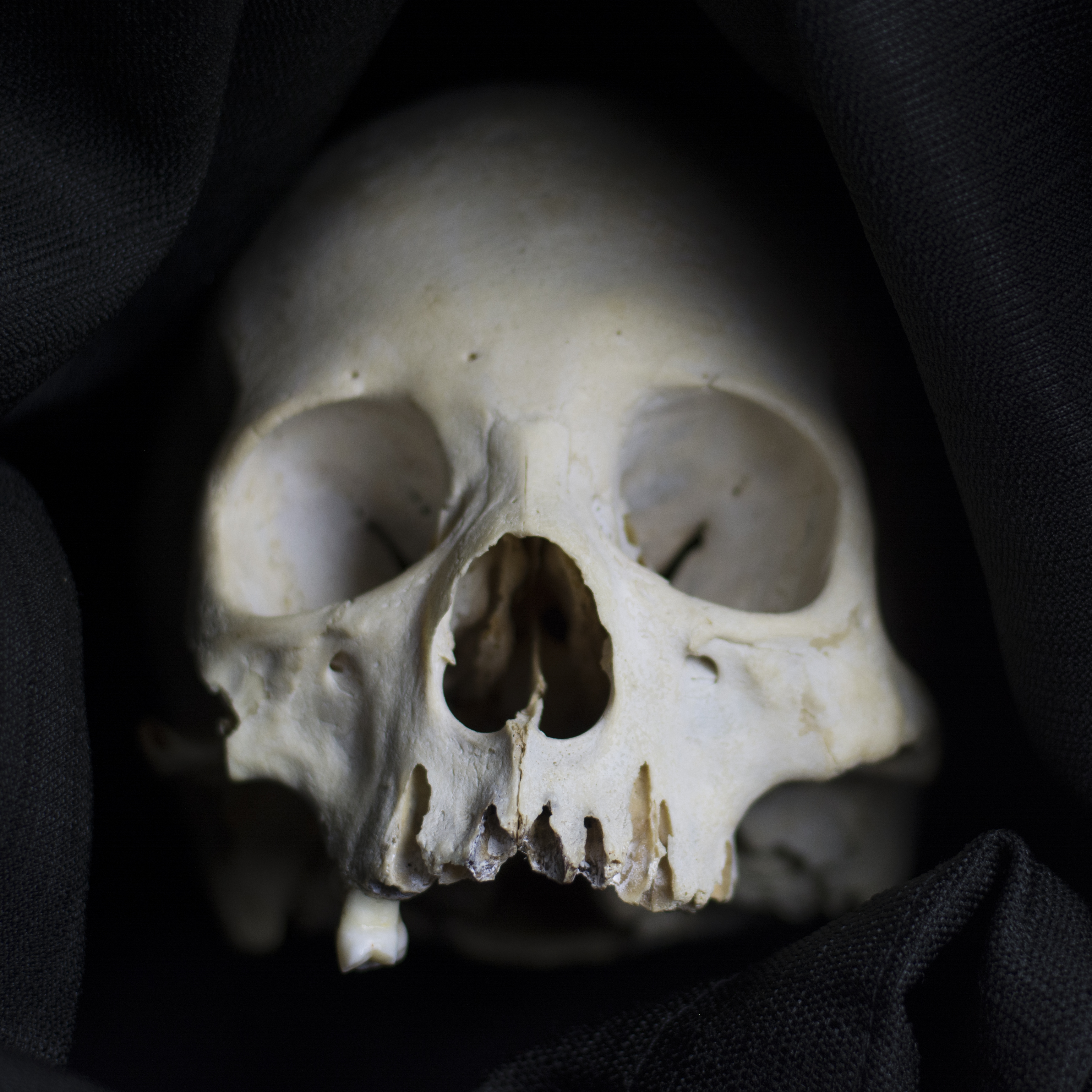 5 Weird Facts About The Human Skull And 5 High Res Images
